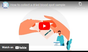 How To Collect a Blood Spot Sample
